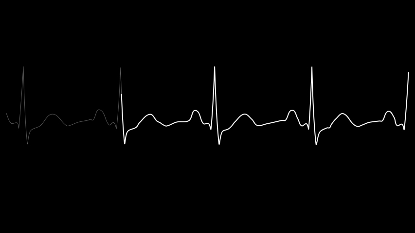 PNG Alpha.ECG looping.Normal Sinus Rhythm.Heart rate. Heart beat line template.Cardiogram monitor.Technological HUD for medicine and science,Medical Institute students. Royalty-Free Stock Footage #1057775608