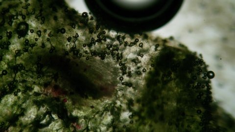 Microscopic algae element with bubbles from the Contagion Collection - Microscopic Video Element