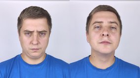Second chin lift in man. Video before and after plastic surgery, mentoplasty or facebuilding. Chin fat removal and face contour correction 