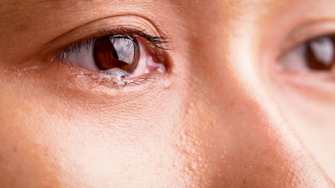 Close up of Asian woman crying with tear and little freckles on her beautiful face.