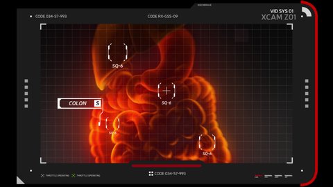 
A high-tech screen displays an x-ray image of the digestive system with glitch effect. Focus and scan individual organs of stomach and intestines with emerging markers with names. Alpha channel.
