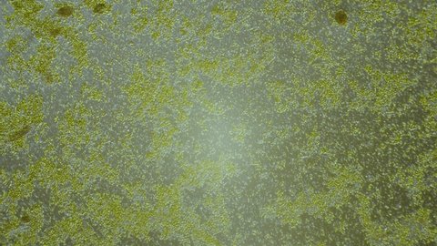 Small green algae flow in water under microscope