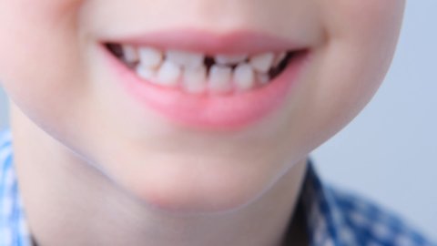 boy, kid opened his mouth, mouth cavity, shows teeth close-up with a finger, performs articulation exercises for the tongue, dental concept, speech therapy
