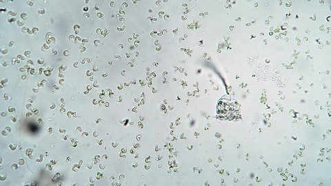 Ciliate vorticella feeds on bacteria in troubled waters. Theme of laboratory biological research under microscope. Microscopic protozoa in a drop of water under magnification. Microcosm close-up.