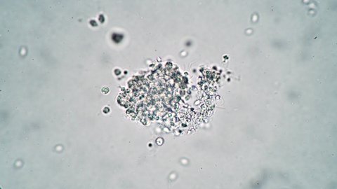 Raging diverse life in a drop of water under a microscope. Theme of laboratory biological research under microscope. Microscopic protozoa in a drop of water magnification. Microcosm background.