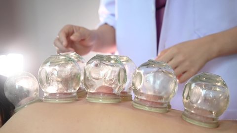 Cupping Therapy .Therapist Giving Cupping Treatment On Back
