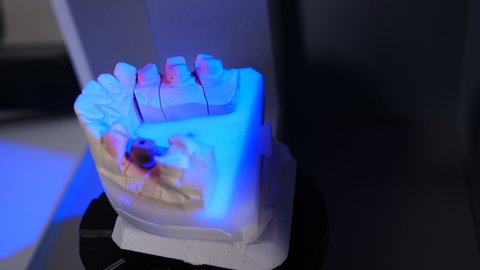 Dental Reconstruction of Jaw with 3D Dental Scanner. Modern dental clinic laboratory. Hi-tech dental 3D scanner with gypsum jaw model. Teeth Mould being analyzed. 4 k video