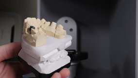 Dental technician working with ceramic crowns on jaw model blowing it with solution before scanning in modern dental clinic laboratory. Dental prosthesis, artificial tooth, prosthetic. 4 k video