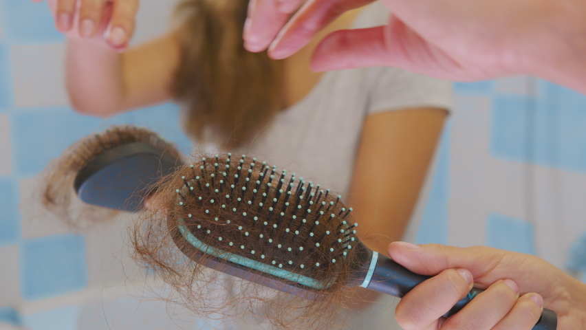 Female hands clean.Lots of fallen hair on a comb. Hair loss problem, hormonal failure, stress, diet, scalp and hair bulb disease. Royalty-Free Stock Footage #1059013760