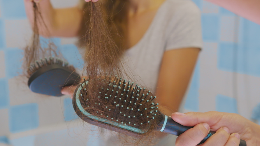 Female hands clean.Lots of fallen hair on a comb. Hair loss problem, hormonal failure, stress, diet, scalp and hair bulb disease. | Shutterstock HD Video #1059013760