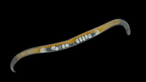 worm Nematoda under the microscope, Phylum Protostomia, free-living nematodes inhabit soil, freshwater and sea. Sample found in the Black Sea