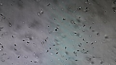 Sperm (spermatozoa) viewed under microscope. Moving human sperm under Phase contrast Microscope. Close-up of spermatozoons. 4 k video