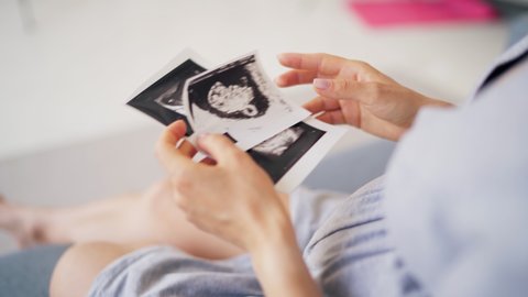 Beautiful pregnant woman wife holding ultrasound baby picture in her hand. Pregnancy woman and maternity healthcare concept.