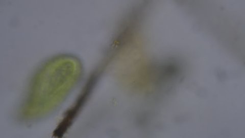 Water protist (Ciliata) under the microscope