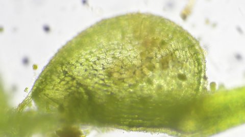 Bladderwort (Urticularia sp.) trap with captured prey under the microscope