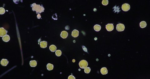 Glenodinium sp.under the microscope for education.

