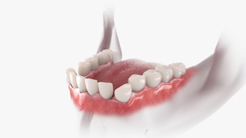 Teeth correction with transparent orthodontic retainer. 3D animation.