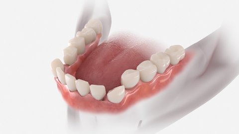 Teeth correction with transparent orthodontic retainer. 3D animation.