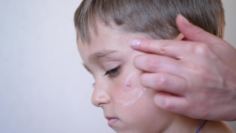 Portrait of a child with allergic inflammation on the face. The doctor's hand applies medicine to the inflammation. Children's health and medicine.