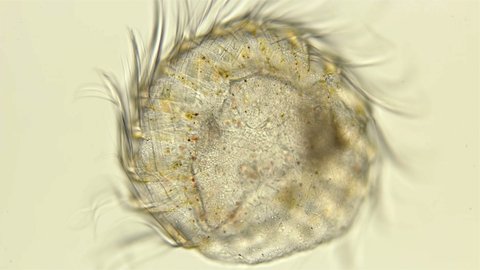 part of Ctenophora with cilia under a microscope. For a while it still moves and contracts, very similar to a larva. The adult Ctenophora will be able to regenerate the lost body parts. Black Sea.