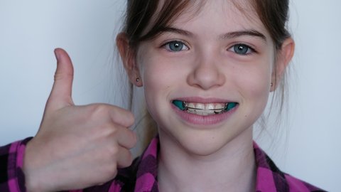 little / young smiling girl wears an orthodontic dental appliance / retainer / braces. Pediatric dentistry and orthodontics, concept