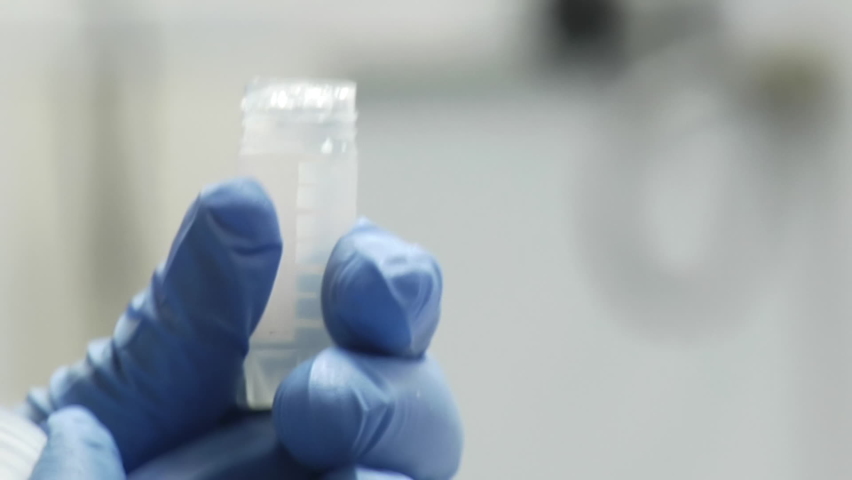 Drawing Up Stem Cells from Vial into Syringe