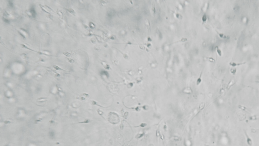 Human sperm under the microscope, macro view through the microscope at Petri Dish with many spermatozoa, 40x magnification