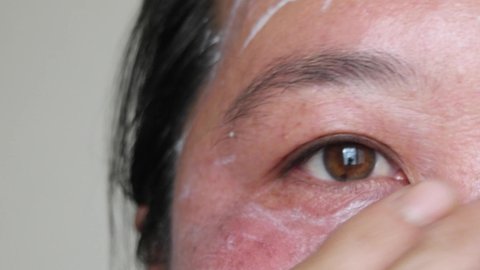 Asian woman 45s,applying skin creams into face skin,or check her skin problem of face,she as melasma freckles due to pigment melanin malfunction due to hormones.Eye wrinkles.Selective focus.
