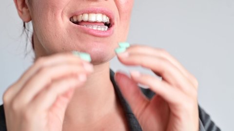A woman uses transparent retainers to whiten teeth