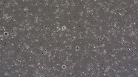 Motile sperm cells magnified under a 20x objective