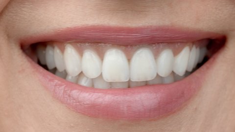 Smile of a charming girl with perfect white teeth close up. Perfect white teeth and a smile.