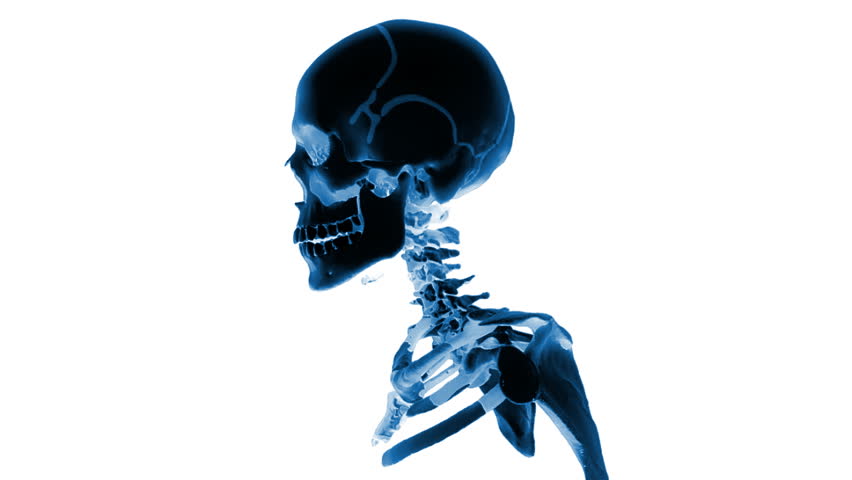 Human x-ray head, medical background