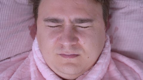 Portrait of sleeping man in funny pink pajamas who has terrible nightmare and so he is drenched in streams of cold sweat on face and mumbles in sleep, top view, close up