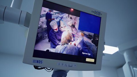 KYIV, UKRAINE - August 2020: Medical monitors in the operating room. Teamwork of surgeons on the screen. Internal organs on a display during surgery.