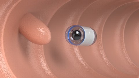 3d rendering capsule endoscopy in intestine 4k footage