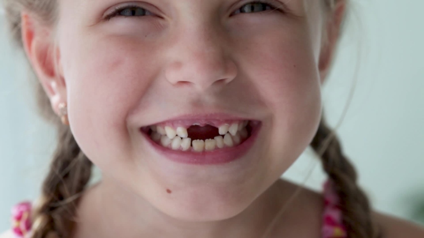 Close-up smile of a girl. A beautiful little girl 6-7 years old has lost milk teeth. Loss of milk teeth, replacement of permanent teeth. Children is dentistry. | Shutterstock HD Video #1061216107