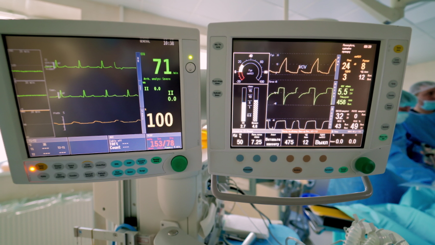Health monitors in intensive care unit. Screen of monitors showing vital signs of a patient during the operation in hospital. Health care concept. Royalty-Free Stock Footage #1061449810