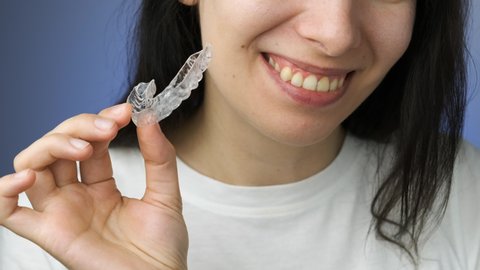 Woman easily inserts and removes invisible transparent aligner from the upper jaw