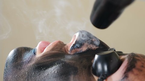 Cosmetologist making carbon face peeling procedure. Laser pulses clean face skin. Hardware cosmetology treatment. Process of laser peeling. Facial skin rejuvenation. 4 k video