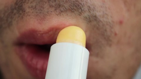 Young Caucasian man with dark hair with dry lips smears lips with male hygienic lip balm.
