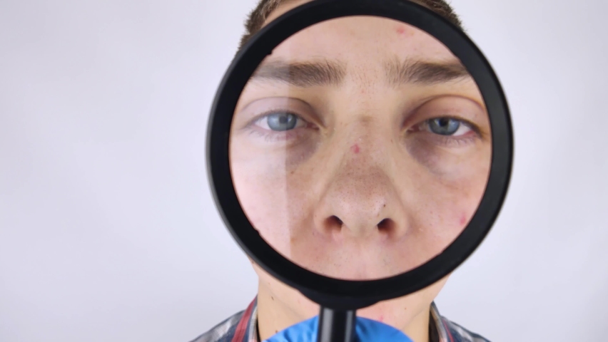 Acne and black dots close-up. A man is being examined by a doctor. Dermatologist examines the skin through a magnifier, a magnifying glass.  | Shutterstock HD Video #1061980201