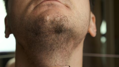 Close up man shaving face and beard with an electric razor. Skin irritation after shaving. 