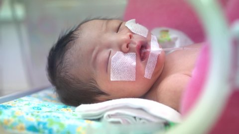 Newborn baby having the the breathing problem after birth. and the digestive system is not in normal condition. newborn in NICU,Neonatal intensive care unit.