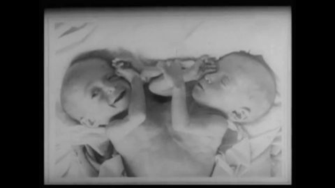 CIRCA 1950s - Infant conjoined twins fall asleep in their cribs.