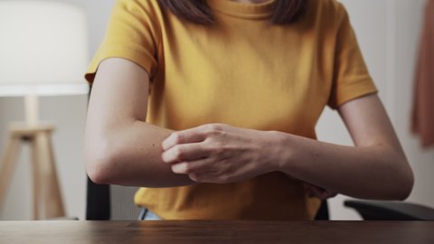 Woman suffering from itching hand, may be caused by allergies or by insect bites.