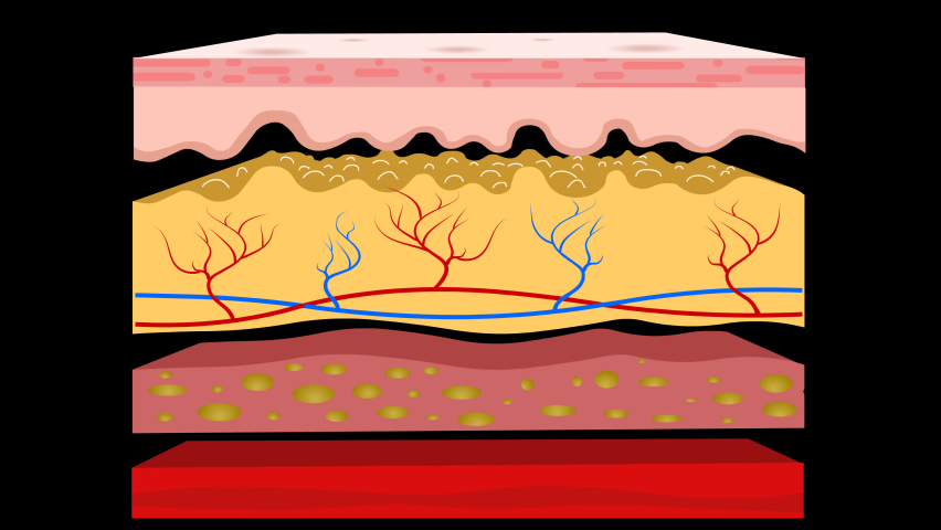 Skin layers anatomy, animation. Structure parts separation, dermis, epidermis, hypodermis, subcutaneous tissue, muscle. Hairless Diagram. Cross section. Transparent Alpha background. Medical video | Shutterstock HD Video #1062231994