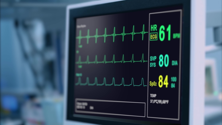 Heart rate monitor in hospital theater. Medical vital signs monitor instrument in a hospital on anesthesia surgery monitor. ECG. Patient heartbeat at the screen | Shutterstock HD Video #1062311950