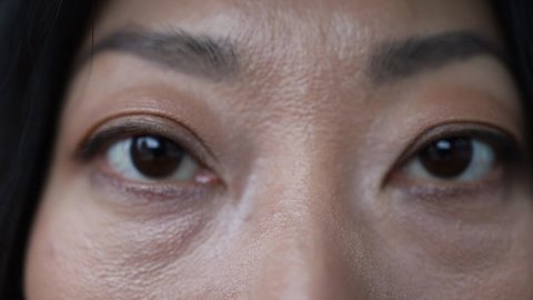 Asian Tired Woman Eyes with bags under the eyes Close Up