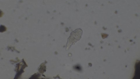 Microscopy of protozoa microorganisms in the water sample, showing ciliates, paramecium, bacteria, spirochaete and algae. Motion of single-celled animals under microscope. 