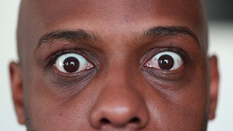 African man SHOCK reaction, Close-up black guy eyes with SURPRISE.